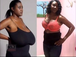 Biggest Natural Breasts in Texas - Woman has 36NNN Breast Reduction